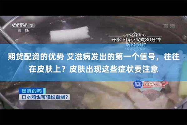 期货配资的优势 艾滋病发出的第一个信号，往往在皮肤上？皮肤出现这些症状要注意